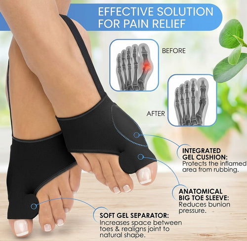 Infographic showing before and after X-rays of a bunion corrector with labels for integrated gel cushion, anatomical big toe sleeve, and soft gel separator